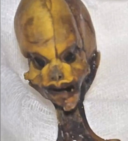 Bộ xương giống người ngoài hành tinh tiết lộ nhiều bí ẩn y học 4