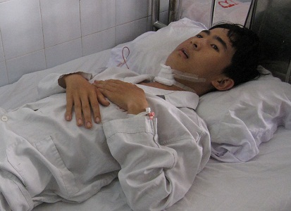 Cấp cứu kịp thời bệnh nhân bị vỡ khối u máu trong xương hàm 1 Cấp cứu kịp thời bệnh nhân bị vỡ khối u máu trong xương hàm 1