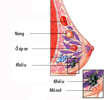 Những "kẻ lạ mặt" đối với núi đôi