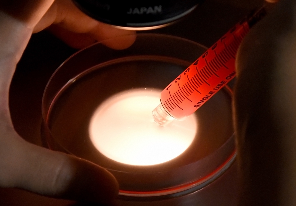 Khoảnh khắc đầu đời - Phép màu từ ống nghiệm- Ảnh 3. Khoảnh khắc đầu đời - Phép màu từ ống nghiệm- Ảnh 3.
