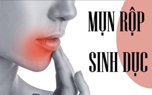 Herpes dễ nhầm lẫn với 4 bệnh ở đường sinh dục