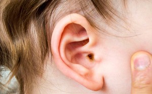 Biến chứng nguy hiểm khi trẻ bị viêm tai giữa