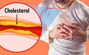 7 loại đồ uống giảm cholesterol tốt cho người tăng mỡ máu