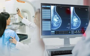 Phát hiện sớm ung thư vú nhờ ứng dụng AI trong chụp nhũ ảnh tầm soát