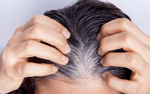 Làm gì để cải thiện tóc bạc sớm, rụng tóc?
