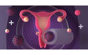 Các yếu tố làm tăng nguy cơ nhiễm HPV gây ung thư cổ tử cung