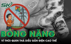 Bỏng điện cao thế do thả diều, câu cá: Nhiều người phải cắt cụt chi - Ảnh 5.