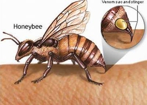 Xử trí nhanh khi bị ong đốt
