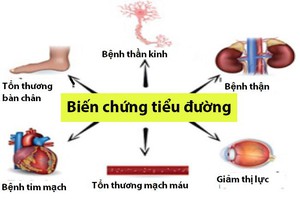 Sống lâu với bệnh tiểu đường không khó