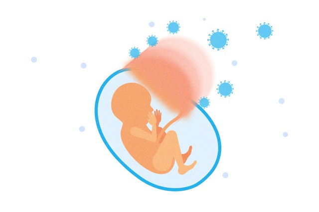Khuyến cáo sức khoẻ khẩn cấp phòng lây nhiễm COVID - 19 với phụ nữ mang thai - Ảnh 6.