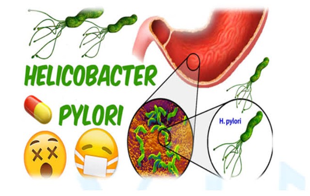 Vi khuẩn Helicobacter pylori và ung thư dạ dày - Ảnh 2.