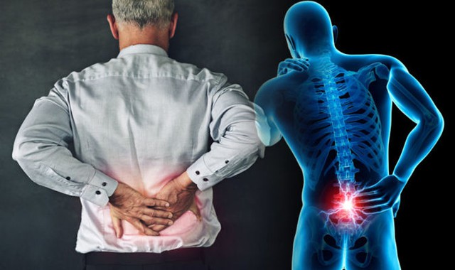 10 cách hiểu về chứng đau lưng và giải đáp của chuyên gia - Ảnh 1.