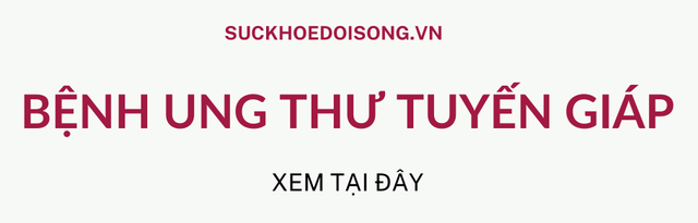 Ung thư tuyến giáp: Phương pháp điều trị, tiên lượng sống và theo dõi nguy cơ - Ảnh 1.