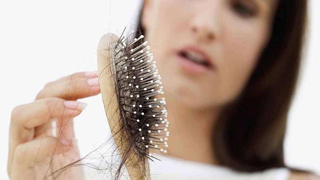 Rụng tóc nhiều là bệnh gì? Nguyên nhân và cách trị rụng tóc tại nhà - Ảnh 1.