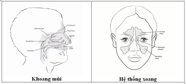 Các loại u lành tính mũi xoang thường gặp: Nhận biết, nguyên nhân và điều trị - Ảnh 3.