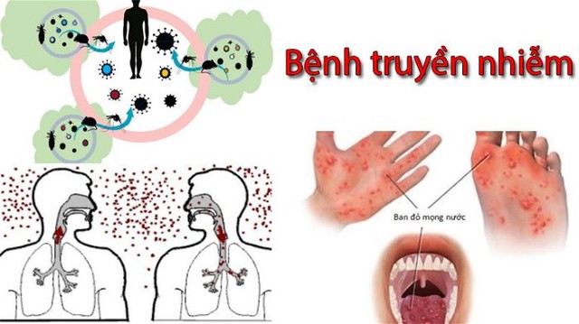 Tăng cường kiểm soát, phòng ngừa bệnh truyền nhiễm - Ảnh 1.