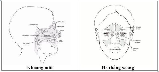 U ác tính mũi xoang: Biểu hiện, phân loại và chẩn đoán - Ảnh 1.