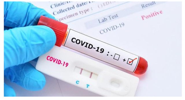 Các xét nghiệm xác định COVID-19 - Ảnh 2.