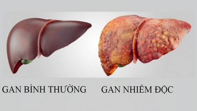   Phương pháp giải độc gan an toàn cho sức khỏe - Ảnh 2.