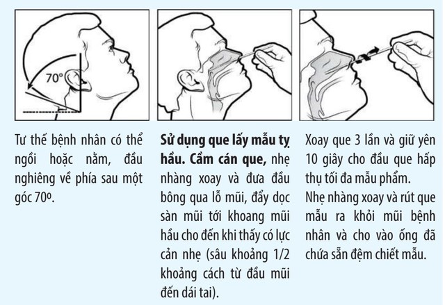 Những lưu ý khi tự test nhanh COVID-19 tại nhà - Ảnh 2.