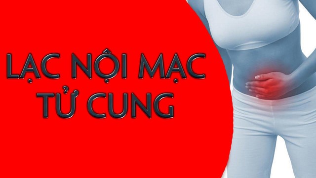 Tiềm năng của thuốc điều trị lạc nội mạc tử cung - Ảnh 2.