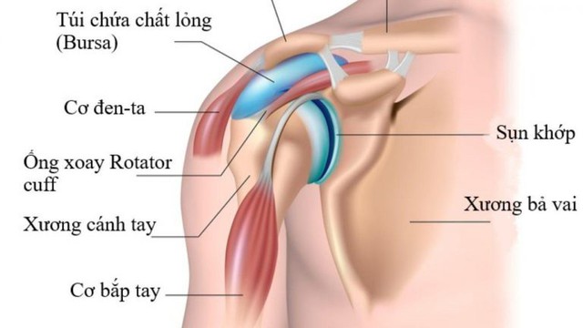 Điểm mặt các nguyên nhân đau khớp vai - Ảnh 1.