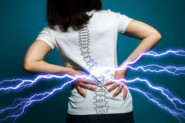 Hội chứng đau thắt lưng: Nguyên nhân, triệu chứng và cách điều trị - Ảnh 6.
