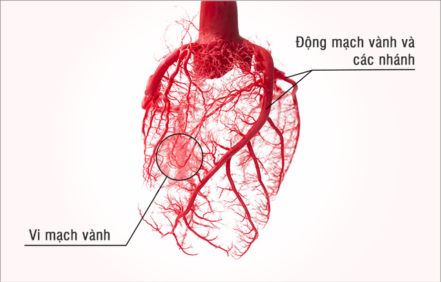 Rối loạn chức năng vi mạch - Nguyên nhân quan trọng gây thiếu máu cơ tim - Ảnh 1.