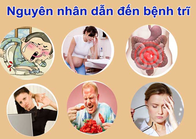 Nguyên nhân gây ra bệnh trĩ. Ảnh minh họa