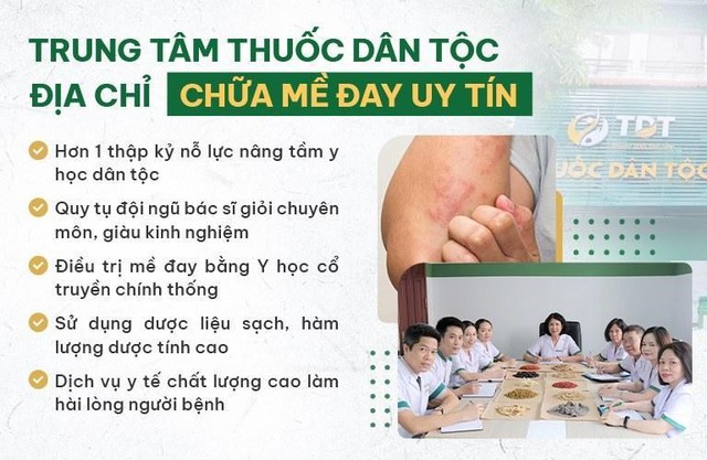 Địa chỉ chữa mề đay bằng Đông y uy tín, chất lượng - Ảnh 1.