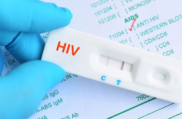 Bạn có biết: Xét nghiệm HIV hoàn toàn miễn phí

 - Ảnh 1.