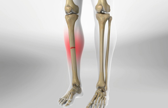 Phát hiện tế bào gốc sửa chữa các chấn thương xương - Ảnh 3.