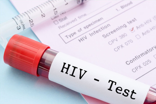 Sau phơi nhiễm với HIV, khi nào nên đi xét nghiệm?

 - Ảnh 1.