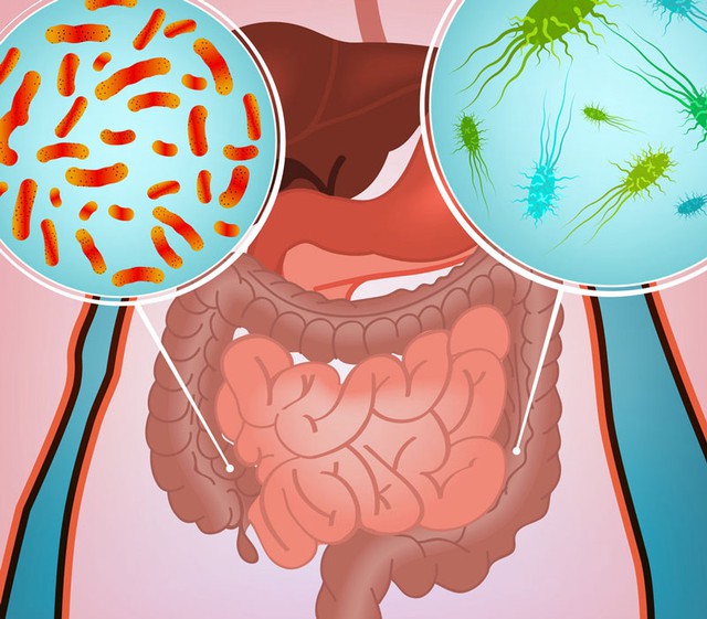 Các loại nhiễm trùng đường ruột và đối tượng dễ mắc - Ảnh 1.