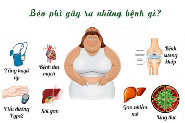 Chẩn đoán béo phì theo chỉ số BMI và điều trị bệnh béo phì - Ảnh 4.