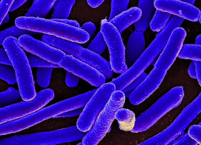 5 chìa khóa để giảm thiểu những vụ ngộ độc thực phẩm nghiêm trọng do vi khuẩn E.Coli - Ảnh 2.