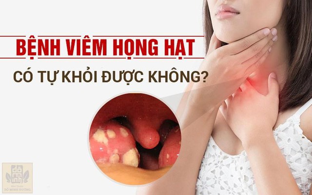 Viêm họng hạt có tự khỏi không? Có nguy hiểm không? - Ảnh 1.