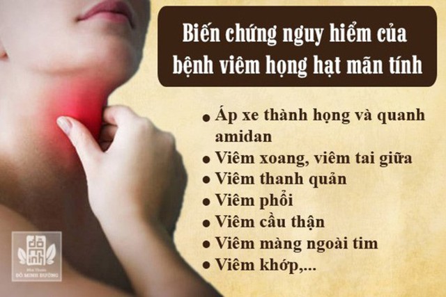 Viêm họng hạt có tự khỏi không? Có nguy hiểm không? - Ảnh 2.