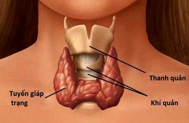 Tăng cân sau mổ tuyến giáp: Thực trạng, nguyên nhân và hướng giải quyết - Ảnh 3.