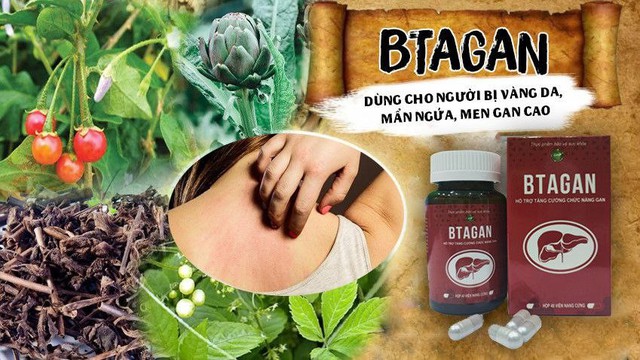 Vàng da, mẩn ngứa do suy giảm chức năng gan phải làm sao? - Ảnh 2.