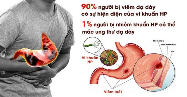 Hỗ trợ điều trị HP dạ dày bằng Đông y - Ảnh 1.