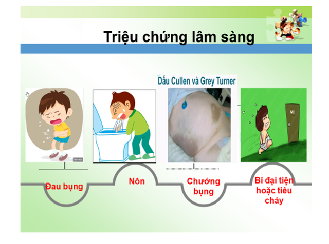 Cứu sống bệnh nhi 10 tuổi bị viêm tụy cấp - Ảnh 2.