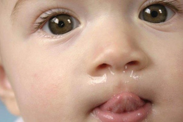 Trẻ sơ sinh bị sổ mũi, ngạt mũi cần xử trí đúng khi thời tiết lạnh - Ảnh 2.