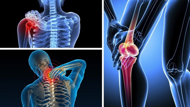 3 bài thuốc Đông y hỗ trợ cải thiện tình trạng đau nhức xương khớp - Ảnh 1.
