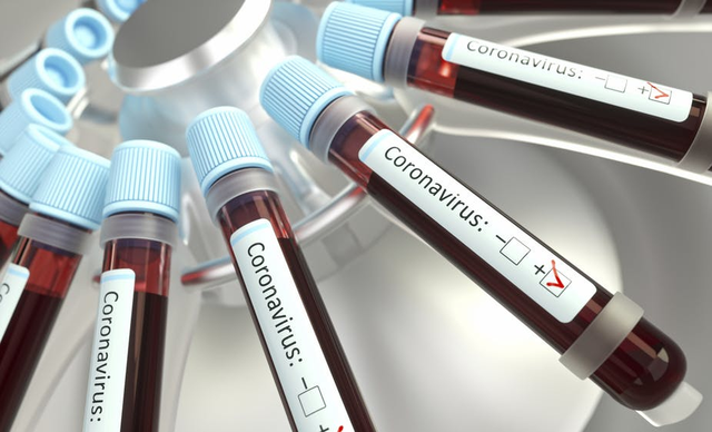 Mối liên quan giữa nhóm máu và nguy cơ mắc COVID-19 trầm trọng - Ảnh 2.