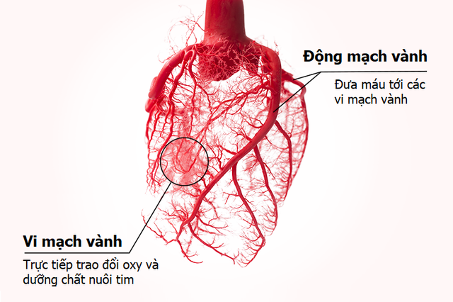 Thiếu máu cơ tim ở người bệnh tiểu đường, huyết áp cao, mạch vành diễn ra như thế nào? - Ảnh 2.