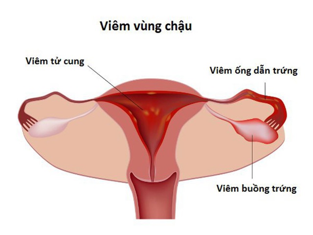 Nguyên nhân nào gây ra hiện tượng co thắt âm đạo? - Ảnh 2.