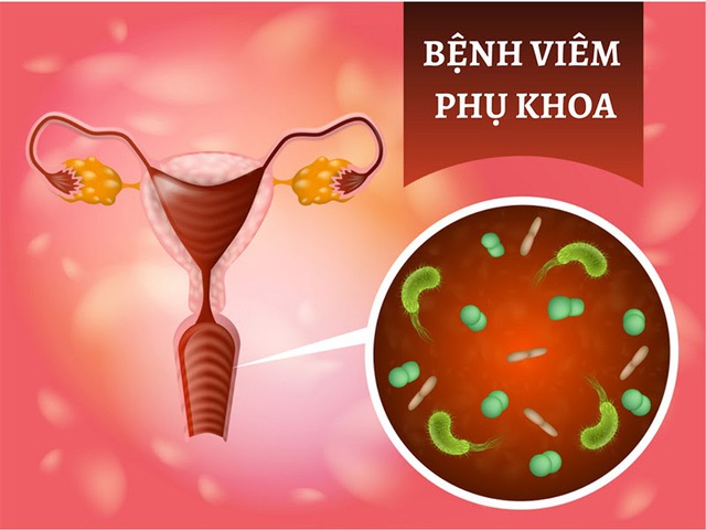 3 bệnh phụ khoa gây biến chứng nguy hiểm cho phụ nữ sau sinh - Ảnh 1.