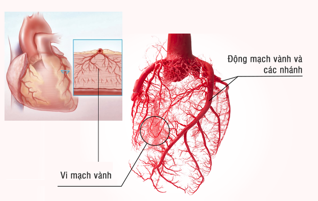 Hỗ trợ cải thiện tình trạng đau thắt ngực, thiếu máu cơ tim với chiết xuất từ thông Dahurian - Ảnh 1.