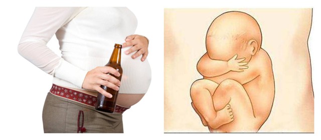 Uống rượu có làm giảm khả năng sinh sản? - Ảnh 2.